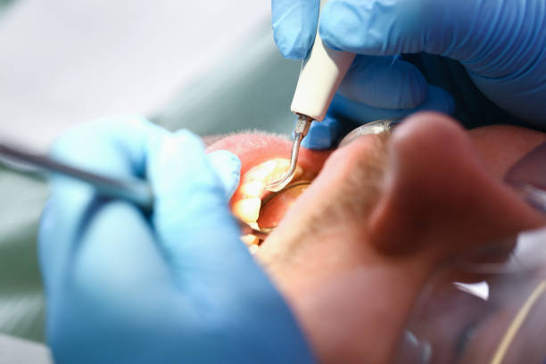 Best Pediatric Emergency Dentist in Hornsby Bend, TX